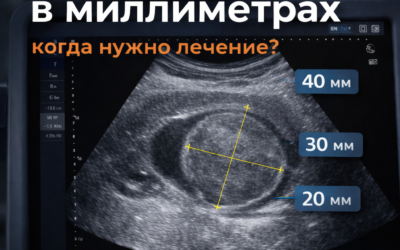 Размер миомы